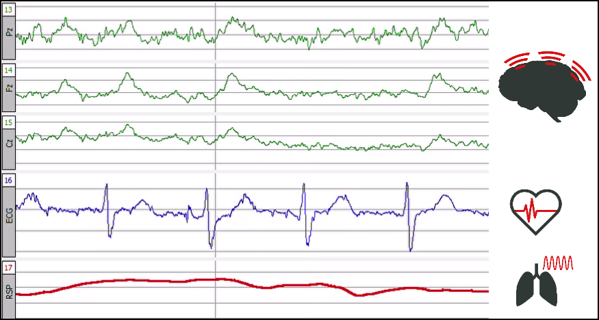 Polygraphy signals